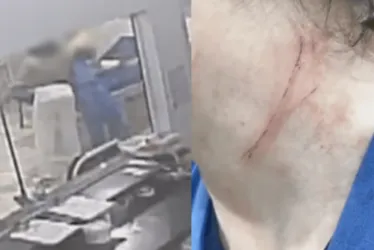 
			
				Vídeo: mulher empurra e enforca enfermeiras dentro de UPA
			
			