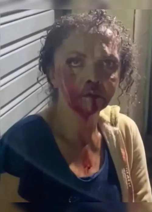 
				Delegado destaca gravidade da agressão em Quebrangulo e investiga suspeito
			
			