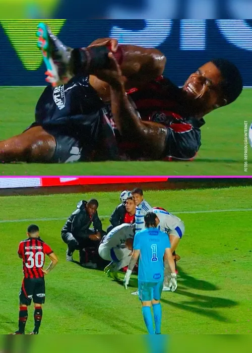 
			
				Jamerson, do Vitória, tem fratura no tornozelo direito e rompe todos os ligamentos
			
			