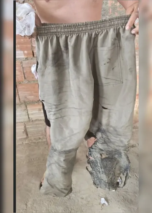  Motorista de app queimado vivo fala pela primeira vez e pede ajuda: “Tou vivo por um milagre” 