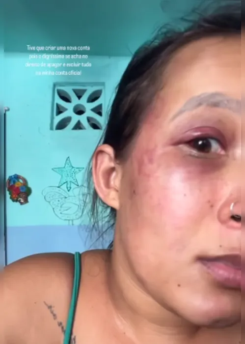 
			
				Tapas, socos, mata-leão: veja o relato de mulher agredida pelo marido
			
			