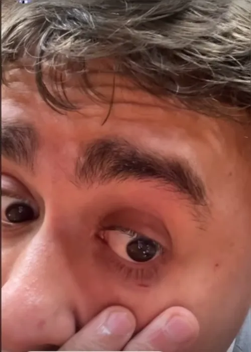 
				Nikolas é atingido no rosto e sangra ao acompanhar Bolsonaro na Câmara
			
			