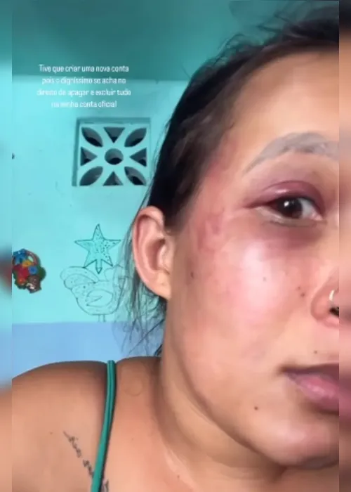 
				Preso suspeito de estrangular ex-companheira que recusou sexo em Maceió
			
			