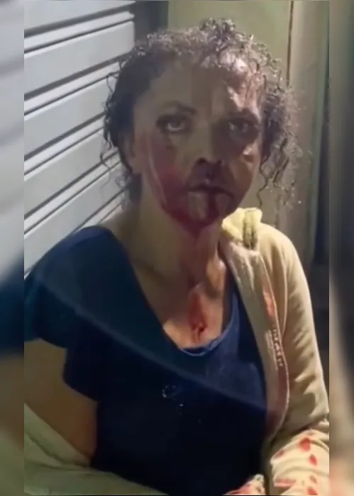 
				Vídeo: mulher é agredida com chute e cai desacordada no meio da rua em Quebrangulo
			
			