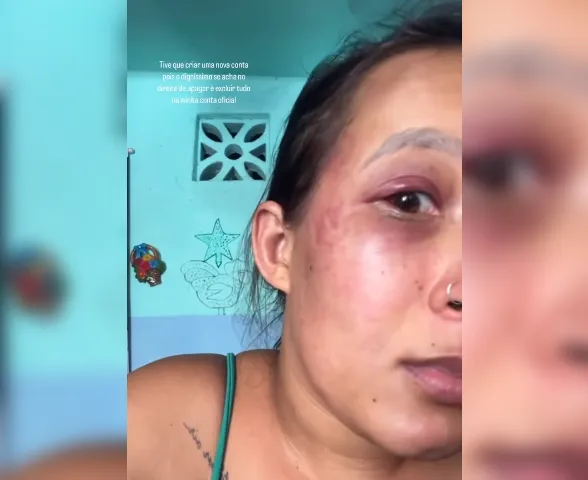 Tapas, socos, mata-leão: veja o relato de mulher agredida pelo marido