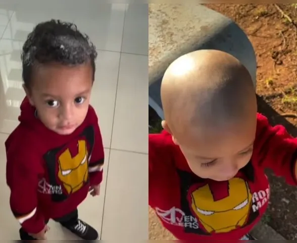 Vídeo: criança usa creme depilatório na cabeça e perde o cabelo