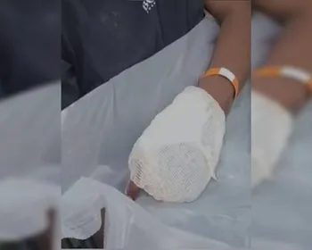 Vítima coloca mão na frente de arma e tem dedos “explodidos”