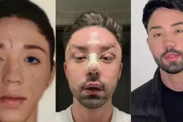 
				Influenciador alagoano é detido em Dubai por não ser reconhecido em foto de passaporte
			
			