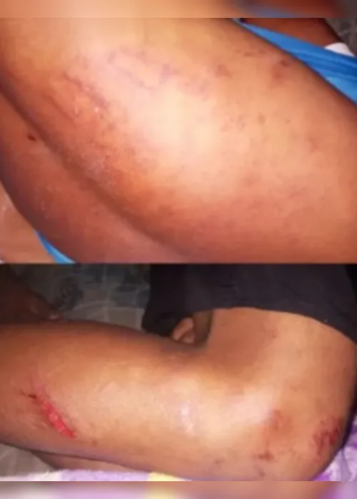 
				Polícia investiga agressão de jovem por guarda municipal em São José da Laje
			
			