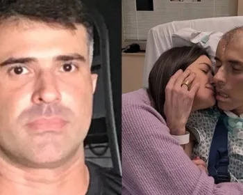 Policial baleado na cabeça em operação no Rio começa a reagir após internação