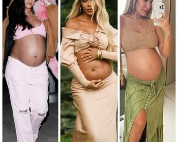 Por que tantas mulheres relatam mais celulite após a gravidez