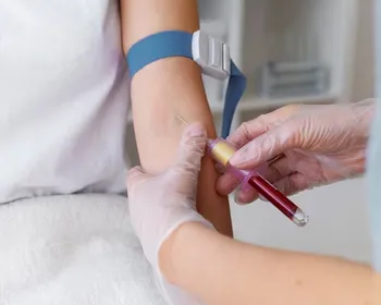 Qual é a quantidade normal de plaquetas no sangue?