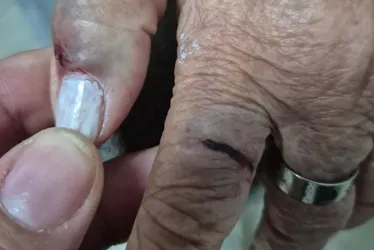 
				Tapas, socos e mordidas: médica é denunciada por agredir tia idosa em Arapiraca
			
			