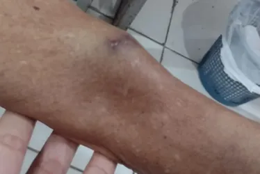 
				Tapas, socos e mordidas: médica é denunciada por agredir tia idosa em Arapiraca
			
			