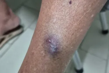 
				Tapas, socos e mordidas: médica é denunciada por agredir tia idosa em Arapiraca
			
			