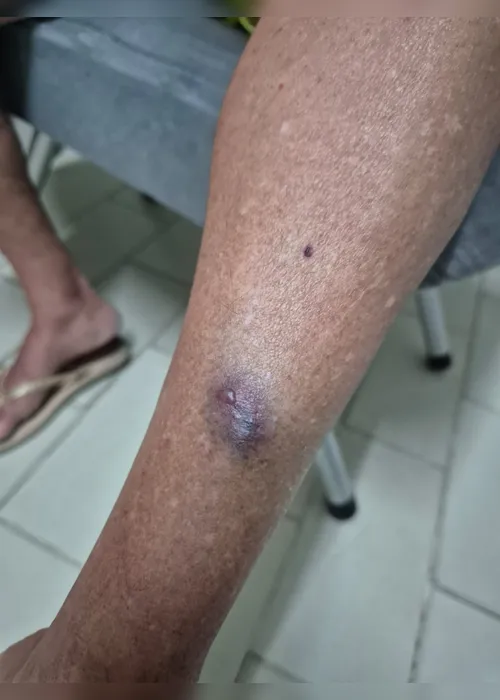 
				Médica é presa duas vezes em Arapiraca por agredir idosa de 77 anos; veja imagens da agressão

			