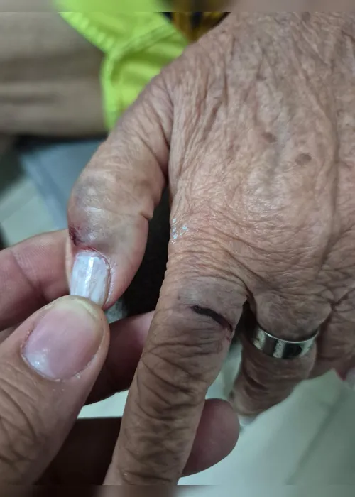 
				Médica é presa duas vezes em Arapiraca por agredir idosa de 77 anos; veja imagens da agressão
			
			
