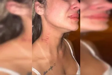 <br /> Influencer coloca câmeras em casa e registra agressão brutal do ex<br /><br />