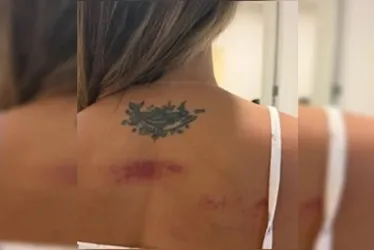 <br /> Influencer coloca câmeras em casa e registra agressão brutal do ex<br /><br />