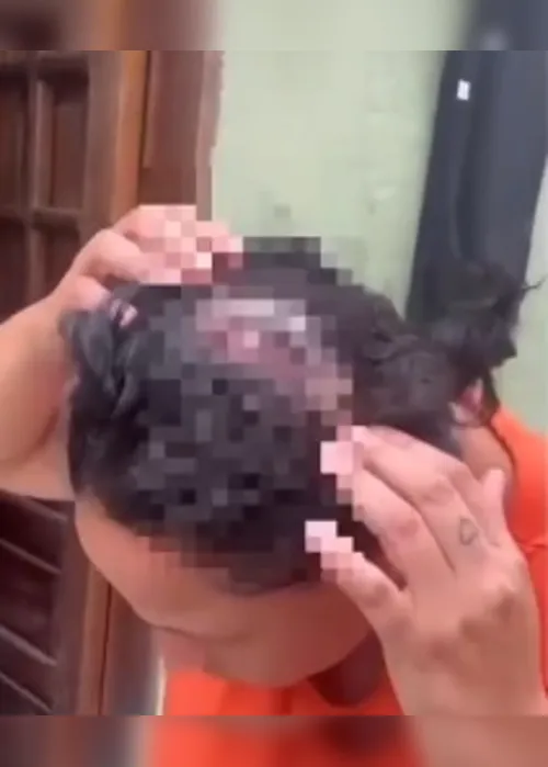 
				Ex tenta matar mulher com facão em Junqueiro; vítima levou 20 pontos na cabeça
			
			