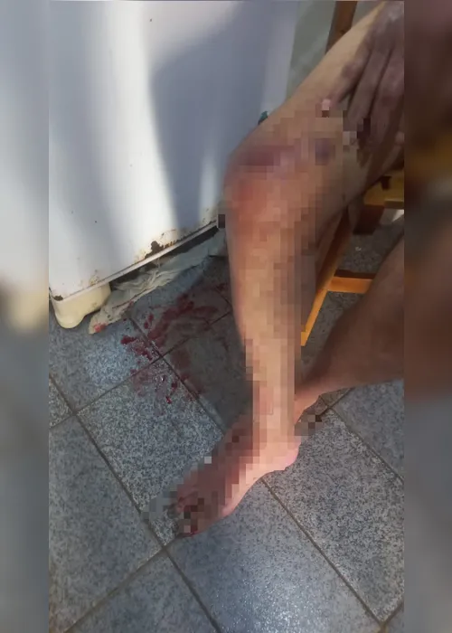 
				Filha é presa por maus-tratos após idoso ser encontrado ferido e em risco em Belo Monte
			
			