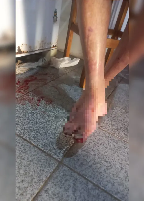 
				Filha é presa por maus-tratos após idoso ser encontrado ferido e em risco em Belo Monte
			
			