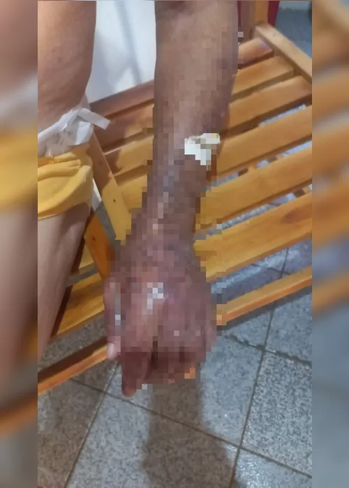 
				Filha é presa por maus-tratos após idoso ser encontrado ferido e em risco em Belo Monte
			
			