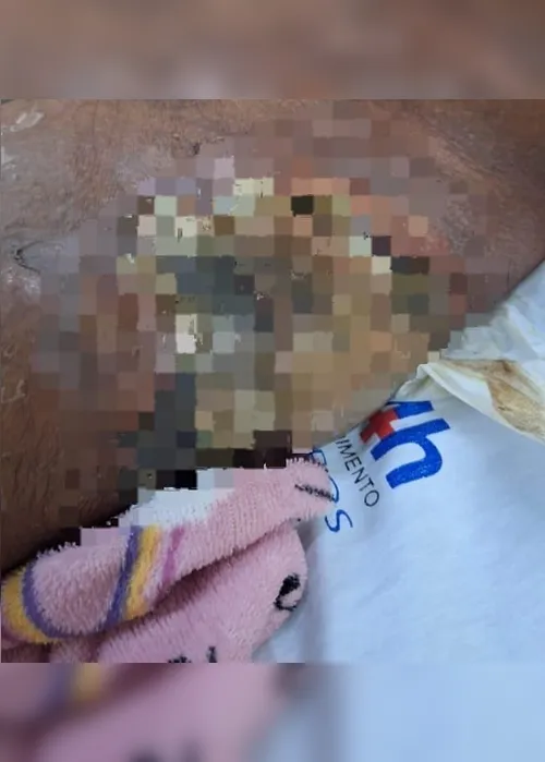 
				Risco de morte e anemia severa: mulher é presa por maus-tratos contra companheiro paraplégico
			
			