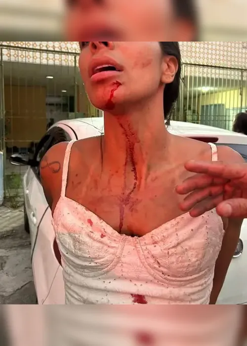 
				Socos e chutes na costela: Jogador é acusado de agredir mulher
			
			