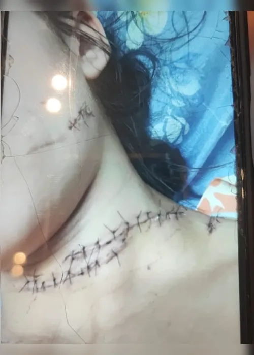 
				Suspeito preso por esfaquear jovem já havia tentado matar a vítima antes, diz Polícia Civil
			
			
