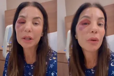 
				Ivete Sangalo fala pela 1ª vez sobre rumores de agressão

			