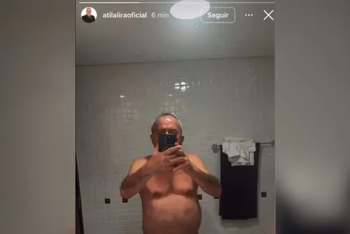 
				Ex-deputado federal publica nude por engano e priva conta
			
			