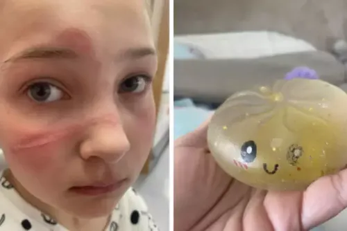 
				Menina de 10 anos queima rosto após fazer trend do TikTok com brinquedo
			
			