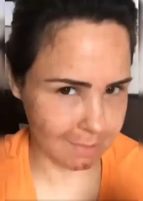 
				É IA? Vídeo de Ana Paula Renault antes de procedimento choca a web
			
			