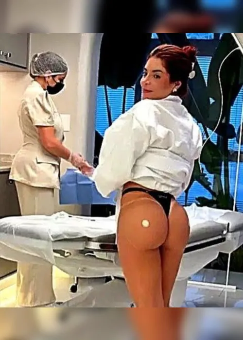 
				Gkay exibe novo procedimento nas redes sociais: o bumbum harmonizado substitui o de academia? Médico responde
			
			