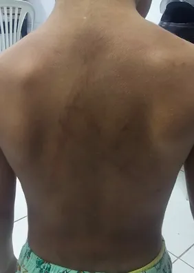Menino de 3 anos é resgatado após denúncia de agressões; mãe e padrasto são presos em Maceió
