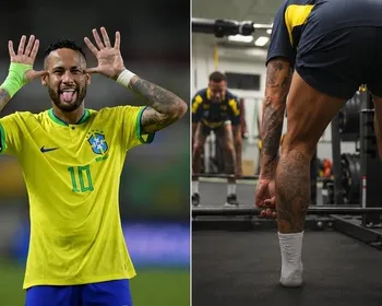 Dá para ter o chamado "bumbum de jogador"? Médico especialista em harmonização glútea explica