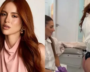 Esposa de Richarlison mostra antes e depois de harmonização glútea e facial