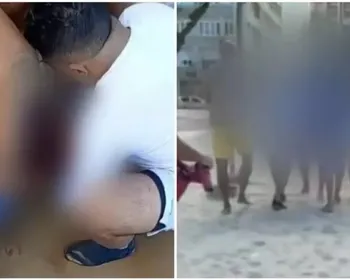 Jovem atacada por tubarão já estava sem a perna ao sair do mar, diz médico