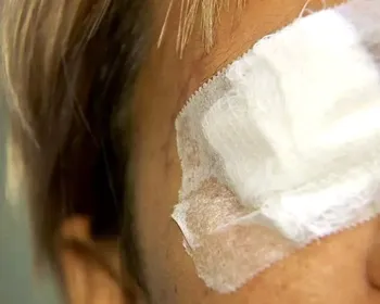 Mulher que perdeu a visão após cirurgia no nariz receberá R$ 50 mil