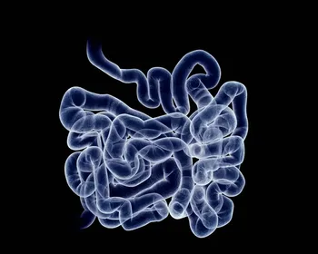 SUS adota novo exame para detectar câncer de intestino antes dos sintomas