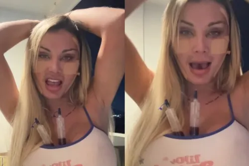 
				Andressa Urach assusta ao aparecer com rosto modificado e faz revelação: ‘Comunicado importante’
			
			