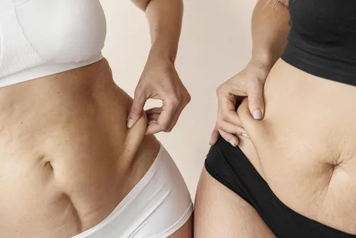 
				O uso de caneta emagrecedora pode causar flacidez íntima?
			
			
