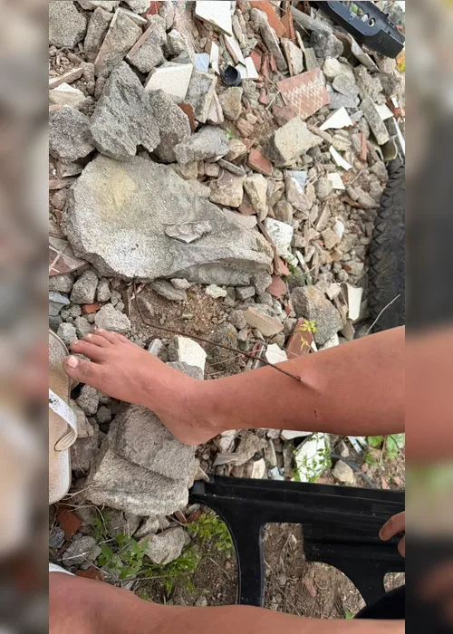 
				Criança fica ferida após ter perna perfurada por vergalhão
			
			