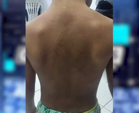 Menino de 3 anos é resgatado após denúncia de agressões; mãe e padrasto são presos em Maceió