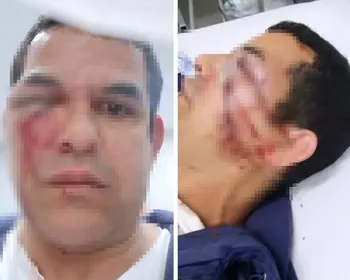 Chamado de "voz de bichinha", vendedor é espancado por seis homens