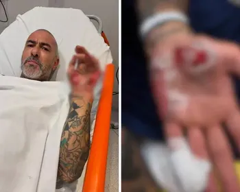 Henrique Fogaça diz que teve aliança roubada em hospital após acidente de moto
