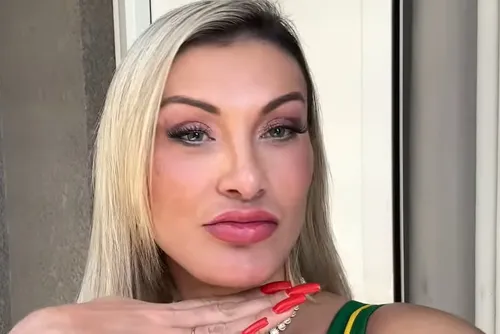 
				Andressa Urach "estreia" novo rosto e revela quanto gastou em procedimento estético
			
			