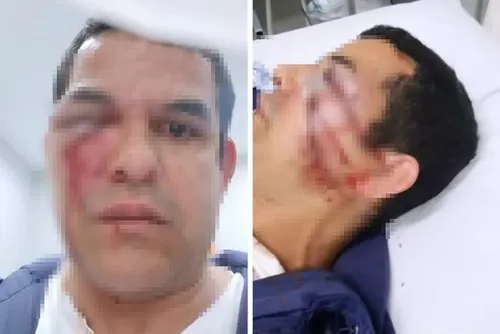 
				Chamado de "voz de bichinha", vendedor é espancado por seis homens
			
			