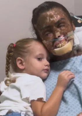 Morre Karine Felipe, influencer que lutava contra doença rara